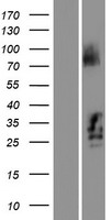 C21orf62 Human Over-expression Lysates NM_019596