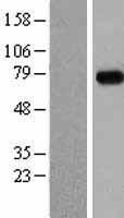 MEPCE Human Over-expression Lysates NM_019606