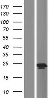 Gastrokine 1 (GKN1) Human Over-expression Lysates NM_019617