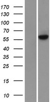 METTL3 Human Over-expression Lysates NM_019852