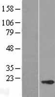 CABP5 Human Over-expression Lysates NM_019855