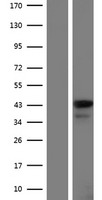 Leukotriene B4 Receptor 2 (LTB4R2) Human Over-expression Lysates NM_001164692