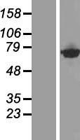 CTPS2 Human Over-expression Lysates NM_175859