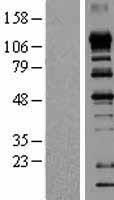 ls056478 eif4enif1 human over expression lysates nm 019843 wb testing 1