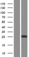 DNAJC12 Human Over-expression Lysates NM_021800