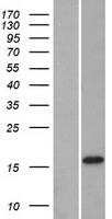 DNAJC12 Human Over-expression Lysates NM_201262
