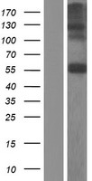 ls056548 chst7 human over expression lysates nm 019886 wb testing 1