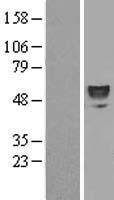 ERO1LB (ERO1B) Human Over-expression Lysates NM_019891