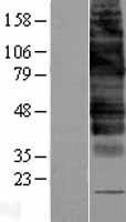 GLUT9 (SLC2A9) Human Over-expression Lysates NM_001001290