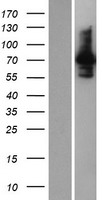 INPP5E Human Over-expression Lysates NM_019892