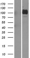 ls056624 asah2 human over expression lysates nm 019893 wb testing 1