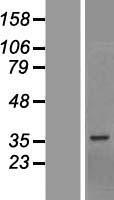 BCCIP Human Over-expression Lysates NM_016567