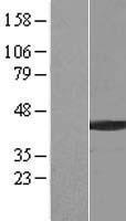 BCCIP Human Over-expression Lysates NM_078468
