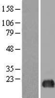 EIF5A2 Human Over-expression Lysates NM_020390