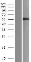 TMPRSS4 Human Over-expression Lysates NM_001173552