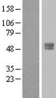 TMPRSS4 Human Over-expression Lysates NM_019894