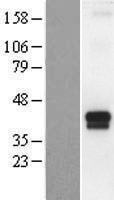 TMPRSS4 Human Over-expression Lysates NM_183247