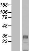 CLDND1 Human Over-expression Lysates NM_001040183