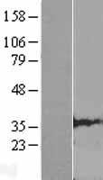 CLDND1 Human Over-expression Lysates NM_001040199