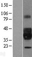 NPDC1 Human Over-expression Lysates NM_015392
