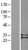 GPR91 (SUCNR1) Human Over-expression Lysates NM_033050