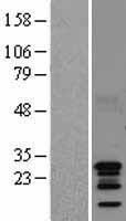 C11orf17 (AKIP1) Human Over-expression Lysates NM_182901
