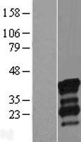 NRIP3 Human Over-expression Lysates NM_020645