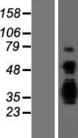 Achaete scute homolog 3 (ASCL3) Human Over-expression Lysates NM_020646
