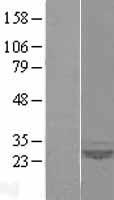SAR1 (SAR1A) Human Over-expression Lysates NM_020150