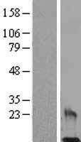 Resistin (RETN) Human Over-expression Lysates NM_020415