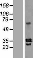 SLAMF8 Human Over-expression Lysates NM_020125