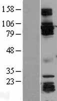 GRASP1 (GRIPAP1) Human Over-expression Lysates NM_020137