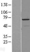 RAD18 Human Over-expression Lysates NM_020165