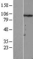 FSTL5 Human Over-expression Lysates NM_020116