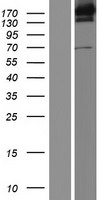 UGGT (UGGT1) Human Over-expression Lysates NM_020120