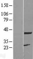 ls056888 pcmf kcmf1 human over expression lysates nm 020122 wb testing 1