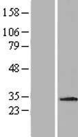 ls056890 mdm1 human over expression lysates nm 020128 wb testing 2