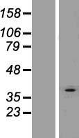 ls056894 agpat3 human over expression lysates nm 001037553 wb testing 1