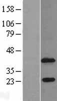 ls056895 1 agp acyltransferase 4 agpat4 human over expression lysates nm 020133 wb testing 1