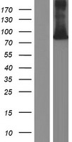 WHIP (WRNIP1) Human Over-expression Lysates NM_020135