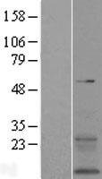 ls056900 tmem167b human over expression lysates nm 020141 wb testing 1