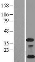 NDUFA4L2 Human Over-expression Lysates NM_020142