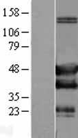 SH3GLB2 Human Over-expression Lysates NM_020145