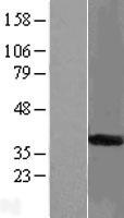 START domain containing 7 (STARD7) Human Over-expression Lysates NM_020151