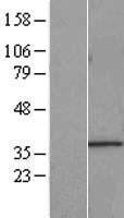 START domain containing 7 (STARD7) Human Over-expression Lysates NM_139267