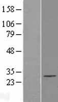 EXOSC5 Human Over-expression Lysates NM_020158
