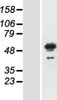 Meis homeobox 3 (MEIS3) Human Over-expression Lysates NM_001009813