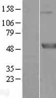 Meis homeobox 3 (MEIS3) Human Over-expression Lysates NM_020160