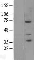 PAK6 Human Over-expression Lysates NM_020168