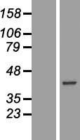 Carbonic anhydrase X (CA10) Human Over-expression Lysates NM_001082533